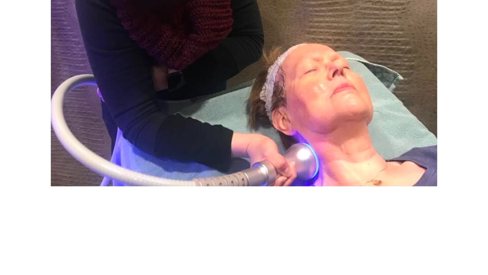 1 sessie cryoskin buik